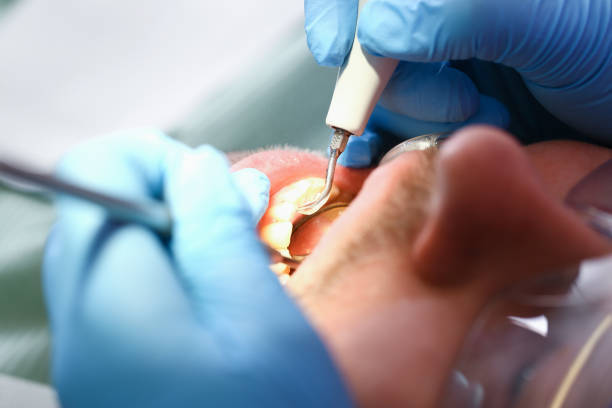 Best Urgent Care for Lost Fillings or Crowns in Henderson, TX
