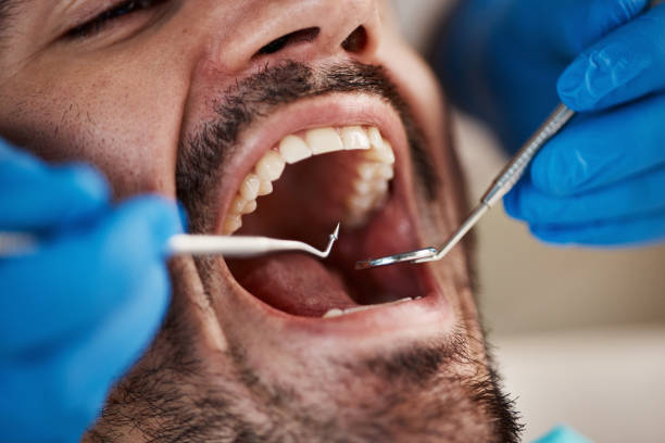 Best Cosmetic Emergency Dentistry in Henderson, TX